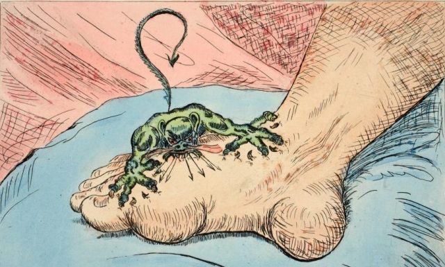 The painful truth about gout