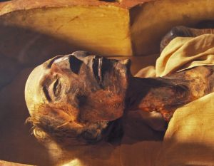 The dilemma of displaying corpses