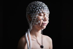 The Alzheimer's industry